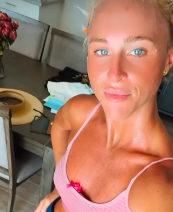 Selfie of a sunburned woman in a pink striped bikini top, standing in a kitchen with a hat on a chair and a vase of pink flowers in the background.